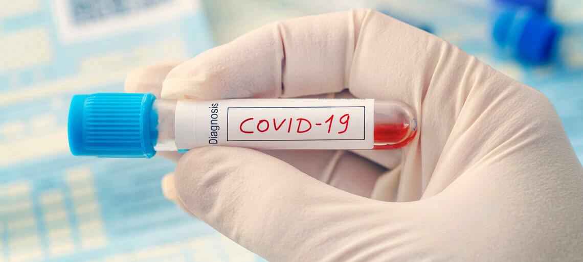 test sierologico covid-19